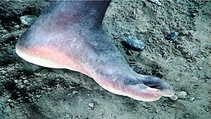 Foot, 2003